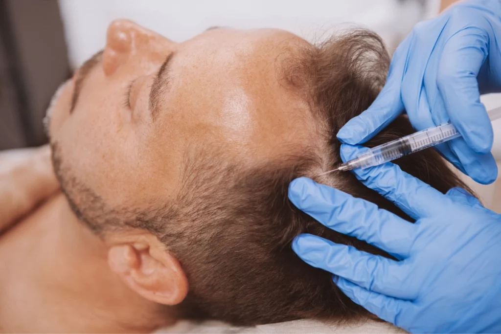 Hair Loss Treatment | Peninsula Plastic Surgery | MD and DE